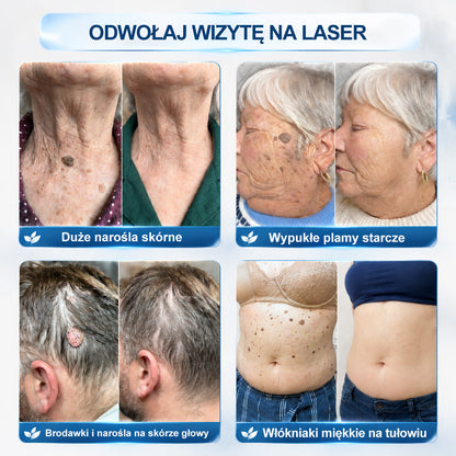 🎁 Zostało już tylko 5 opakowań Hiskin®! Zaoszczędź dziś dodatkowe 30% i zadbaj o gładszy, bardziej jednolity wygląd skóry, zanim ta ograniczona czasowo oferta dobiegnie końca!