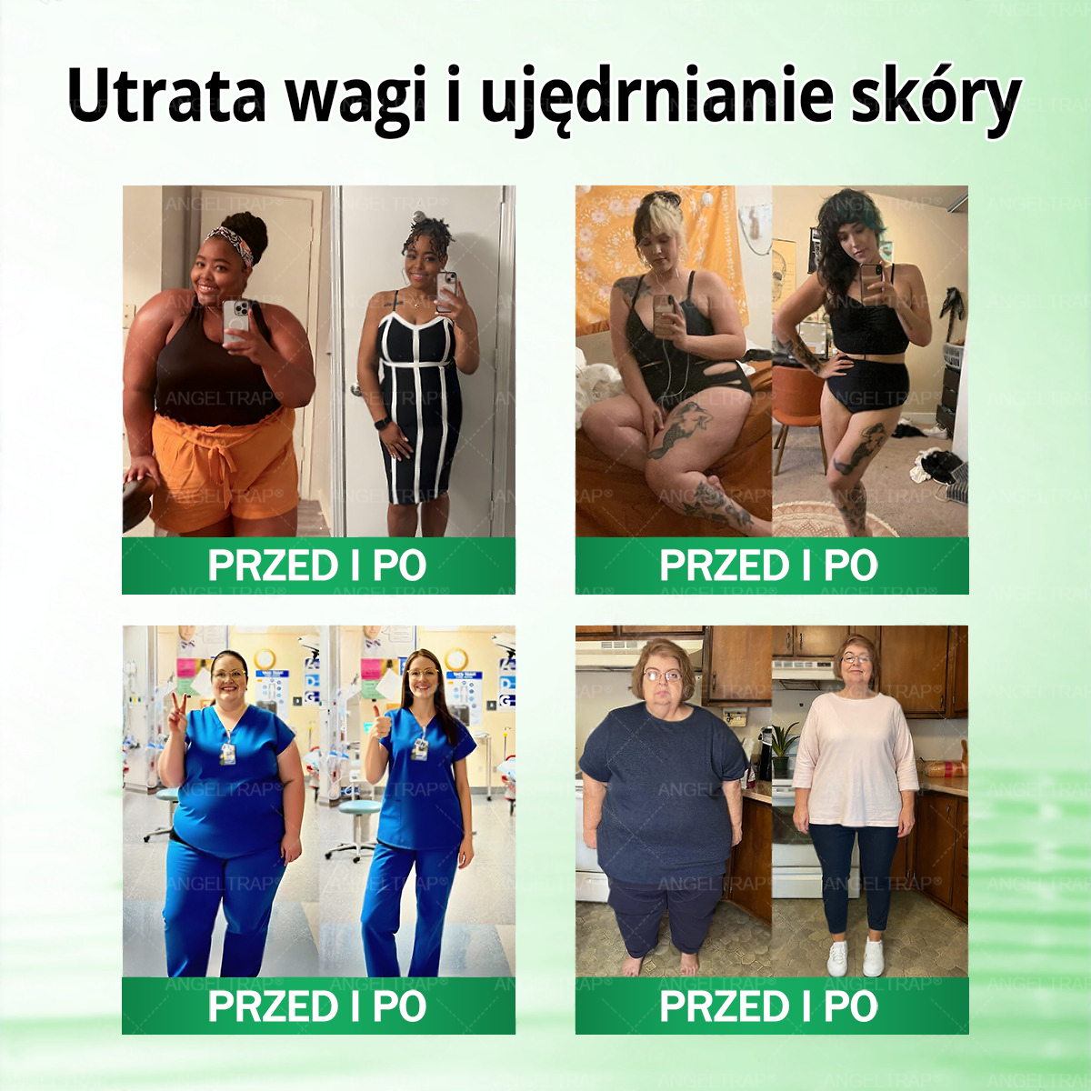 🎁 Zostało już tylko 5 opakowań ANGELTRAPO®! Zaoszczędź dziś dodatkowe 30% i zadbaj o gładszy, bardziej jednolity wygląd skóry, zanim ta ograniczona czasowo oferta dobiegnie końca!