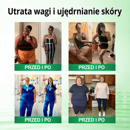 🎁 Zostało już tylko 5 opakowań ANGELTRAPO®! Zaoszczędź dziś dodatkowe 30% i zadbaj o gładszy, bardziej jednolity wygląd skóry, zanim ta ograniczona czasowo oferta dobiegnie końca!
