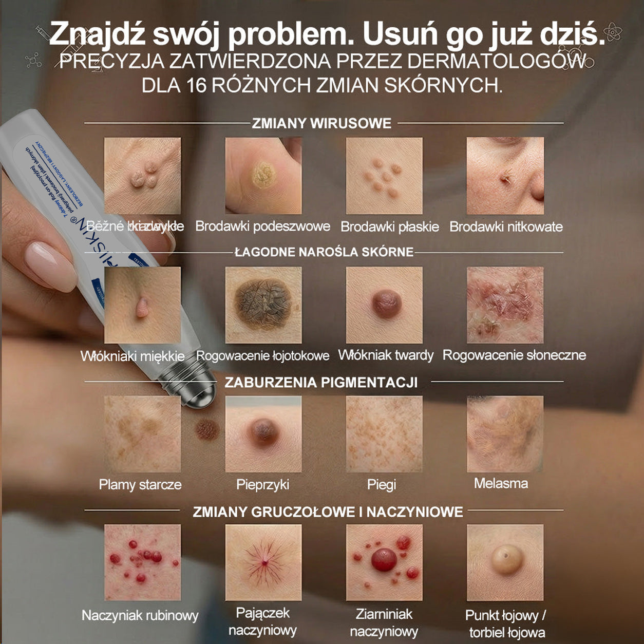 🎁 Zostało już tylko 5 opakowań Hiskin®! Zaoszczędź dziś dodatkowe 30% i zadbaj o gładszy, bardziej jednolity wygląd skóry, zanim ta ograniczona czasowo oferta dobiegnie końca!